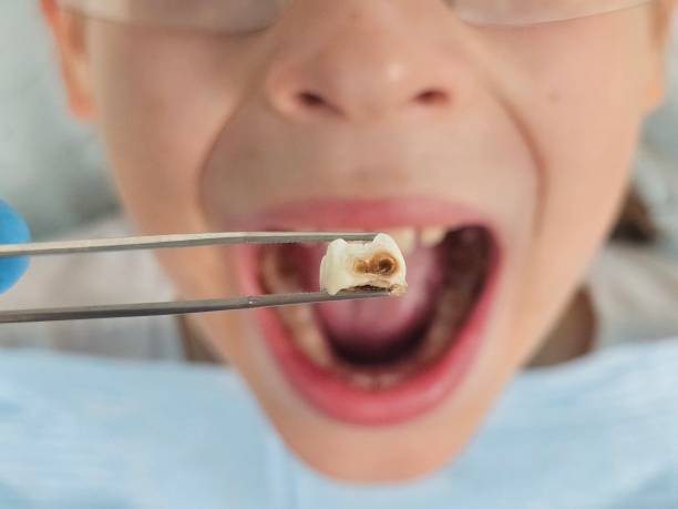 Best Pediatric Emergency Dentist in Menifee, CA